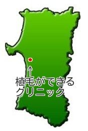秋田県で自毛植毛ができるクリニックは秋田市の千秋久保田町
